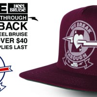 New Heel Bruise: Free Snapback Hat!